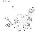 Fig. 06 - Feeding tube system with imaging assembly and console