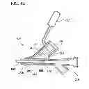 Fig. 45 - Feeding tube system with imaging assembly and console