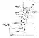 Fig. 01 - MULTI-STAGE PROCEDURES WITH A MODIFIABLE FIBER AND A GUIDE TUBE CONTAINING AN INSTRUMENT