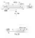 Fig. 02 - MULTI-STAGE PROCEDURES WITH A MODIFIABLE FIBER AND A GUIDE TUBE CONTAINING AN INSTRUMENT