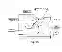 Fig. 05 - MULTI-STAGE PROCEDURES WITH A MODIFIABLE FIBER AND A GUIDE TUBE CONTAINING AN INSTRUMENT