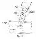 Fig. 06 - MULTI-STAGE PROCEDURES WITH A MODIFIABLE FIBER AND A GUIDE TUBE CONTAINING AN INSTRUMENT