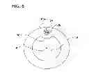 Fig. 08 - Imaging Catheter Assembly