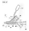 Fig. 45 - Imaging Catheter Assembly