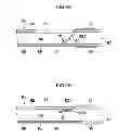 Fig. 06 - Insertion assisting tool for endoscope