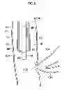 Fig. 08 - Insertion assisting tool for endoscope