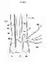 Fig. 09 - Insertion assisting tool for endoscope