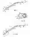 Fig. 02 - Illuminated suction apparatus
