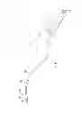 Fig. 05 - MRI-GUIDED CATHETERS