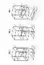 Fig. 03 - Image processing method and system for 3D display of a patient's organ