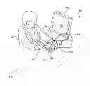 Fig. 01 - Ultrasound device for needle procedures