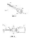 Fig. 06 - Ultrasound device for needle procedures