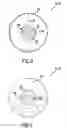 Fig. 06 - Carotid artery occluding apparatus with first and second occluding balloons