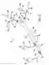 Fig. 09 - Carotid artery occluding apparatus with first and second occluding balloons