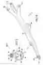 Fig. 10 - Carotid artery occluding apparatus with first and second occluding balloons
