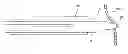 Fig. 01 - Surgical access and nerve surveillance