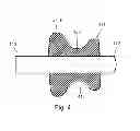 Fig. 04 - Lumen occlusion detection
