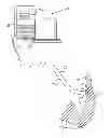 Fig. 01 - Catheter with strain gauge sensor