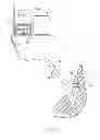 Fig. 02 - Catheter with strain gauge sensor