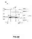 Fig. 06 - Methods for noninvasive skin tightening