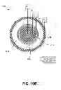 Fig. 20 - Methods for noninvasive skin tightening