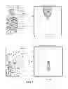 Fig. 28 - Methods for noninvasive skin tightening