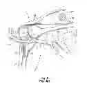 Fig. 02 - SOFT TISSUE THERAPY DEVICE AND METHOD OF USE THEREFOR