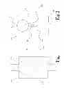 Fig. 02 - Device for regulating gravitational pressure in a shunt system