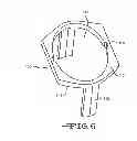Fig. 09 - Introducer handle notch design/concept