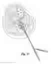 Fig. 14 - Multi-lumen biologic-delivering device