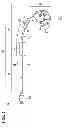 Fig. 02 - Coronary artery catheter and engaging method therefor