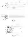 Fig. 07 - Soft tip cannula