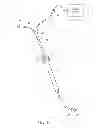 Fig. 02 - Methods and apparatus for coagulating and/or constricting hollow anatomical structures
