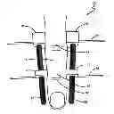 Fig. 01 - Bilateral dynamic external distractor for the treatment of complex fracture luxations of the proximal interphalangeal joint of the hand