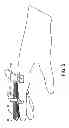 Fig. 05 - Bilateral dynamic external distractor for the treatment of complex fracture luxations of the proximal interphalangeal joint of the hand