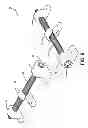 Fig. 08 - Bilateral dynamic external distractor for the treatment of complex fracture luxations of the proximal interphalangeal joint of the hand