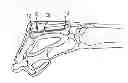 Fig. 01 - Metacarpal bone stabilization device