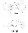 Fig. 15 - Wireless cardioresonance stimulation