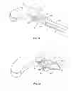 Fig. 07 - Expanding interbody implant and articulating inserter and method