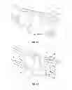 Fig. 08 - Expanding interbody implant and articulating inserter and method