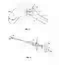Fig. 09 - Expanding interbody implant and articulating inserter and method