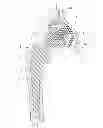 Fig. 01 - Interlocking reverese hip and revision prosthesis and method