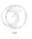 Fig. 07 - Interlocking reverese hip and revision prosthesis and method