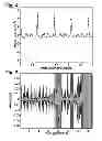 Fig. 04 - Physiological signal quality classification for ambulatory monitoring