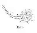 Fig. 02 - Breast protection device