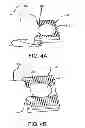 Fig. 05 - Head and Neck Support Device