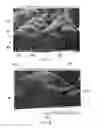 Fig. 05 - NOVEL THREE DIMENSIONAL STRUCTURES USEFUL AS CLEANING SHEETS