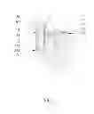 Fig. 08 - Caster device with a directional mechanism