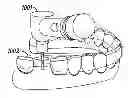 Fig. 01 - SURGICAL GUIDE FABRICATION