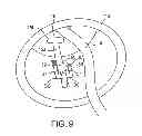 Fig. 09 - Housing attaching devices and assemblies